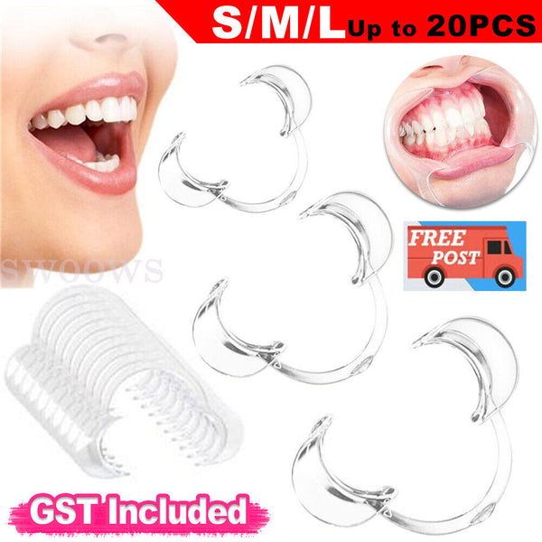 Up 20PCS Cheek Retractors Teeth Whitening Lip & Mouth Opener Holder Dental SML