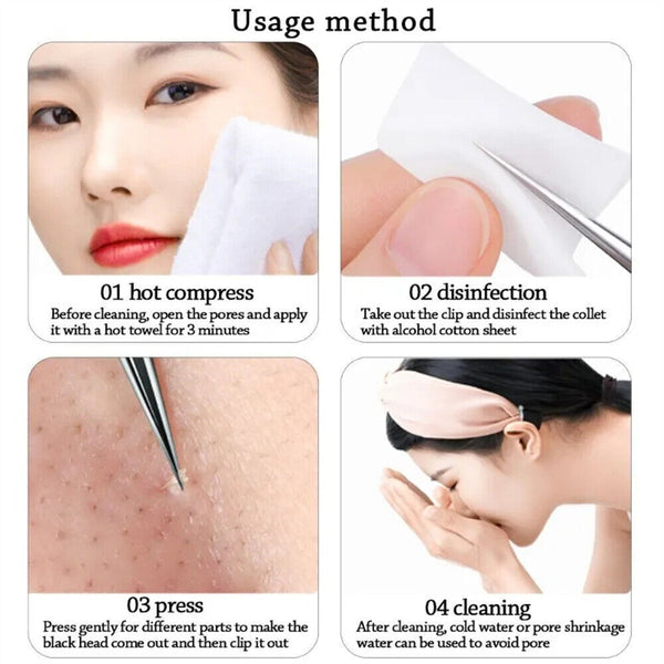 UP15Closing Beauty Salon Cell Clip Blackhead Tweezers Pimple Remover Acne Needle