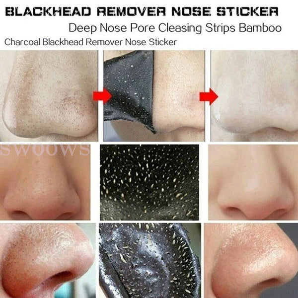 Up 100x Blackhead Remover Strips Face Clean Deep Pore Peel Off Sticker Acne Mask