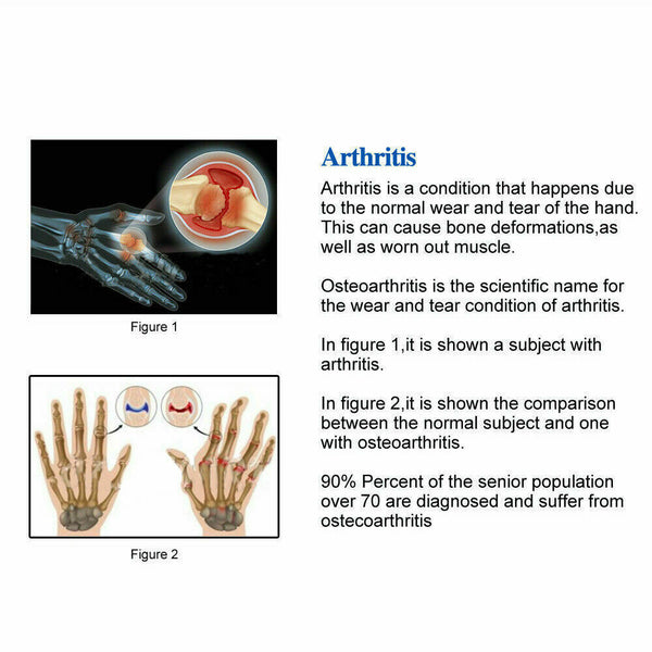 UP5pairs Arthritis Gloves Compression Joint Finger Hand Wrist Support Brace