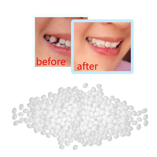 Temporary Tooth Repair Kit Teeth Gaps False Teeth Solid Glue Denture Adhesive AU