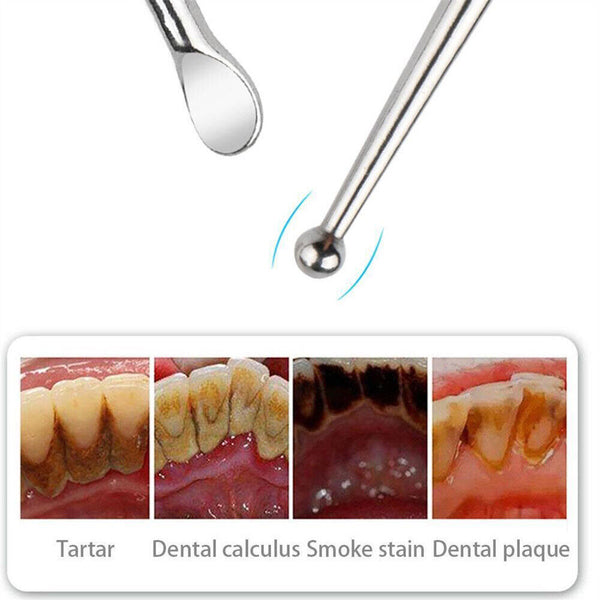 Tonsil Stone Remove Tool StainlessSteel Cleaner Removal Mouth Cleaning Oral Care