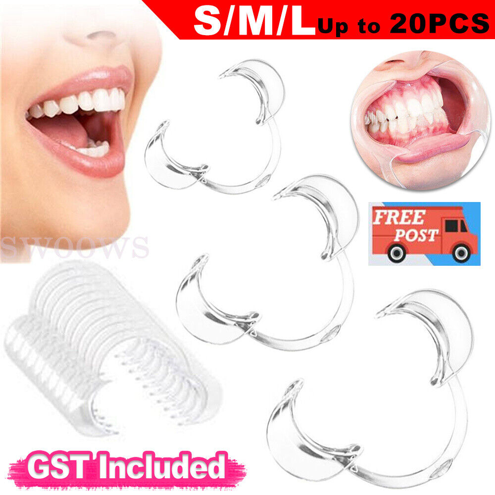 Up 20PCS Cheek Retractors Teeth Whitening Lip & Mouth Opener Holder Dental SML