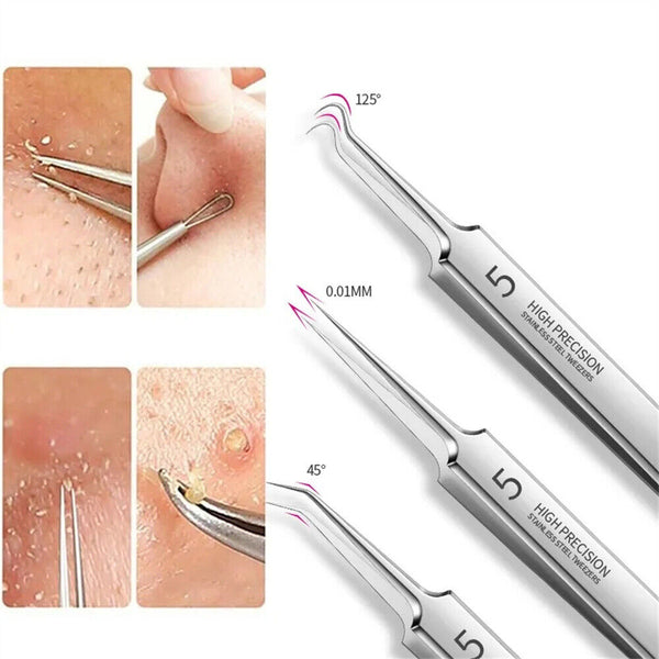 UP15Closing Beauty Salon Cell Clip Blackhead Tweezers Pimple Remover Acne Needle