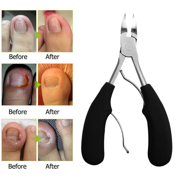 Professional Toenail Clippers Podiatrist's Nippers For Thick And Ingrown Nail