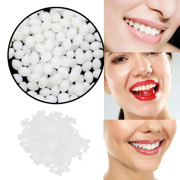 Temporary Tooth Repair Kit Teeth Gaps False Teeth Solid Glue Denture Adhesive AU