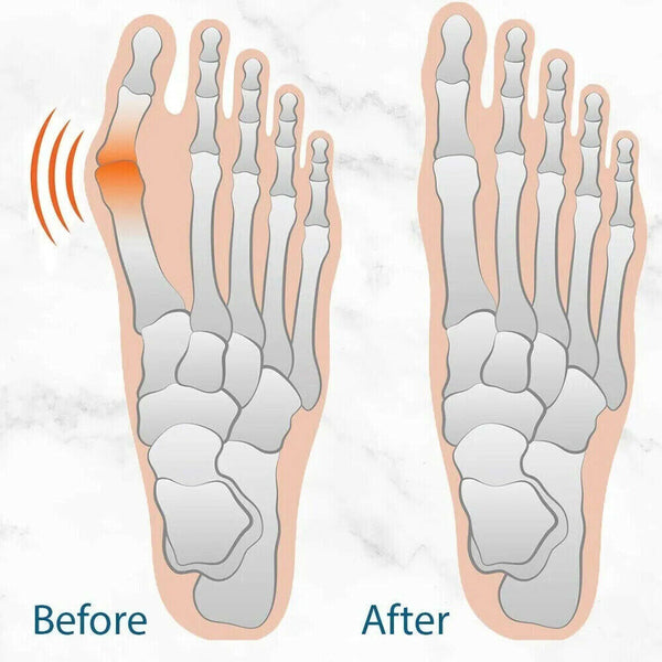 Thumb Valgus Corrector Cloth Foot Protector Thumb and Toe Valgus Foot Cover