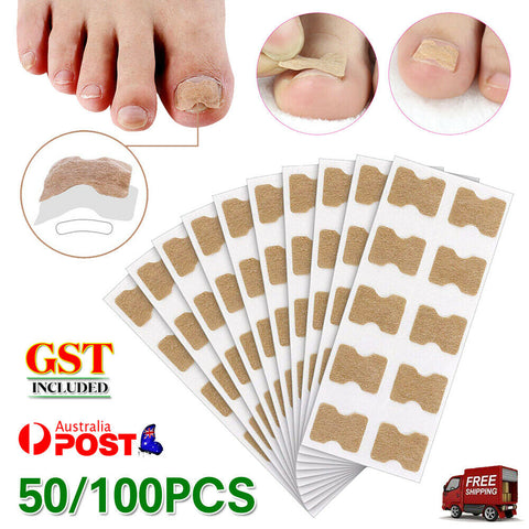 50/100x Glue Free Toenail Toe Ingrown Nail Correction Patch Sticker Foot Care