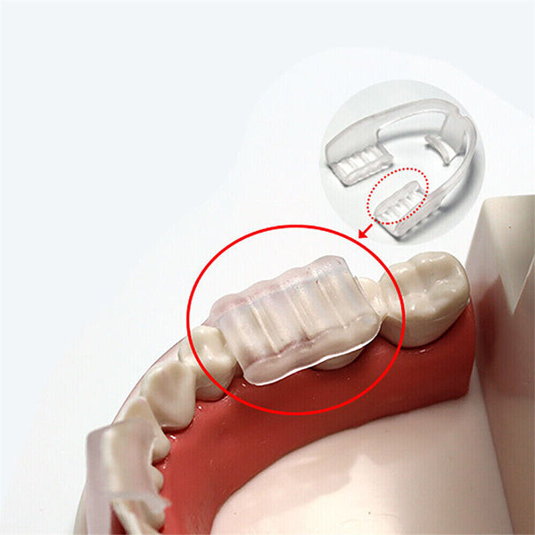 Dental Mouth Night Guard Tooth Grinding Bruxism Grind Sleep Teeth Protector AU