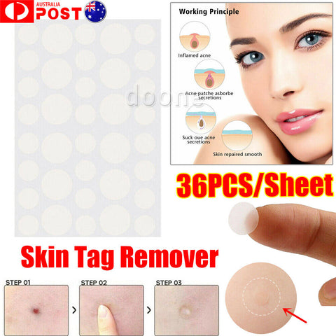 36Pcs Invisible Patches Acne Plasters Pimple Sticker Skin Tags Remover Easy Fast