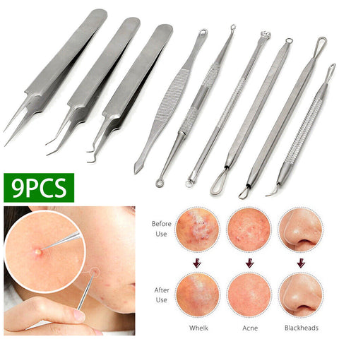 9pcs Blackhead Remover Extractor Tool Pimple Blemish Popper Comedone Kit Clip