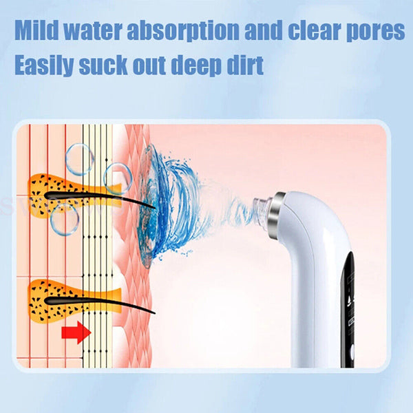 Vacuum Blackhead Remover Facial Skin Pore Acne Pimple 6 Sucker Cleaner Machine