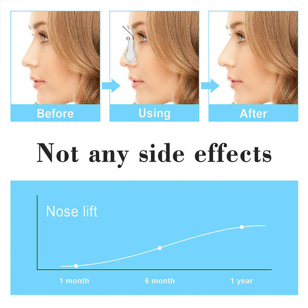 Nose Up Shaping Shaper Lifting Bridge Straightening Beauty Clip Face Corrector