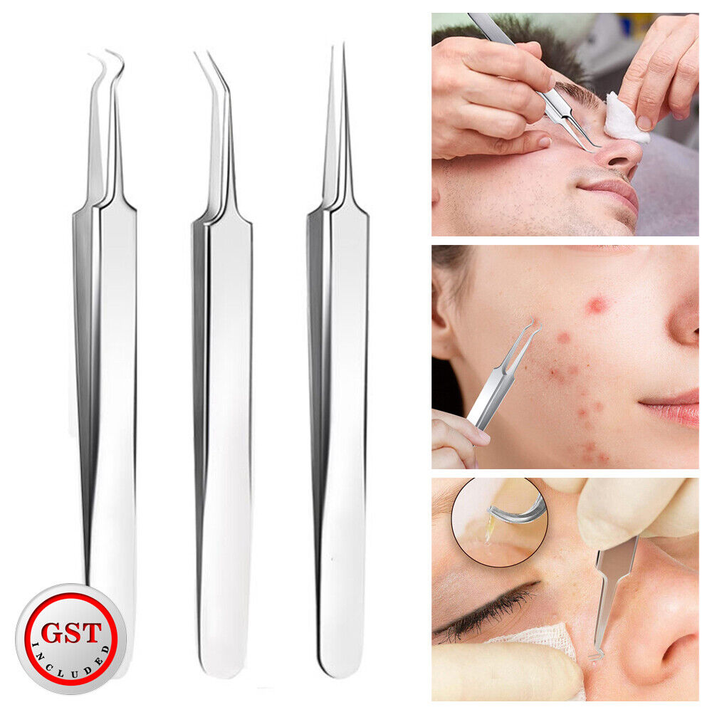 3 Pcs Curved Blackhead Acne Clip Needle Tweezers Pimple Popper Extractor Remover