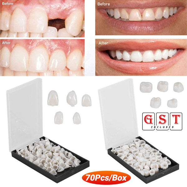 70pcs/box Temporary Crowns Posteriors Anteri Molar Resin Tooth Teeth Caps Dental