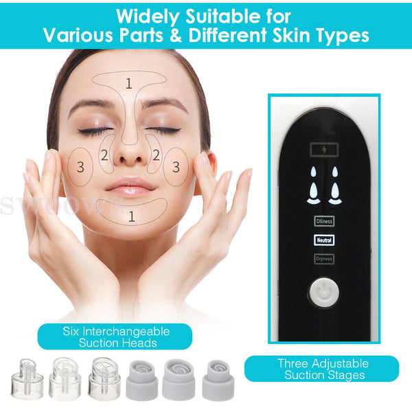 Vacuum Blackhead Remover Facial Skin Pore Acne Pimple 6 Sucker Cleaner Machine