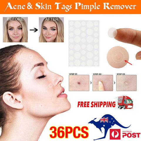 144PCS Dermopatchy Acne Skin Tag Pimple Remover Patch Removal Facial Care Spot