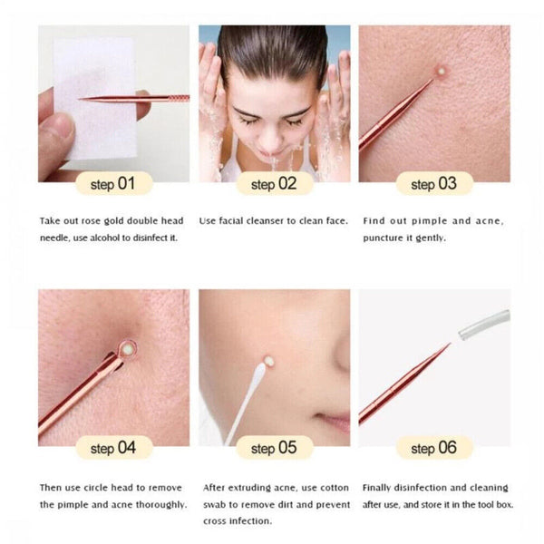 4pcs Blackhead Remover Tool Pimple Popper Pore Blemish Comedone Acne Cleaner