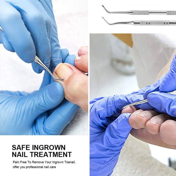 Podiatry Ingrown Toe Nail Lifter correction Nail Cleaner Manicure Pedicure Tool