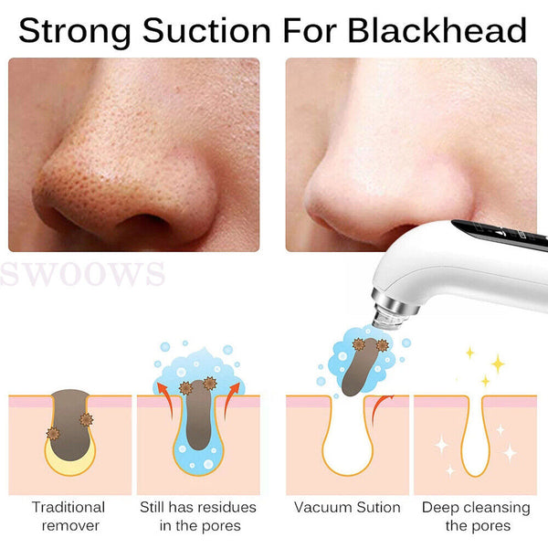 Vacuum Blackhead Remover Facial Skin Pore Acne Pimple 6 Sucker Cleaner Machine