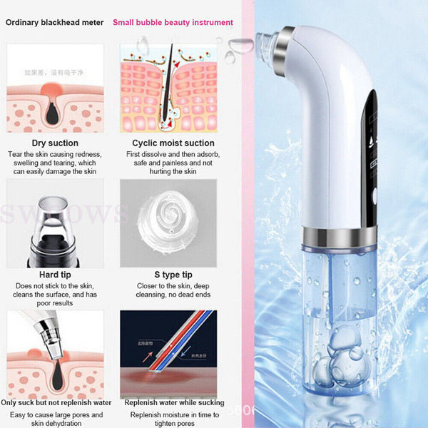 Vacuum Blackhead Remover Facial Skin Pore Acne Pimple 6 Sucker Cleaner Machine