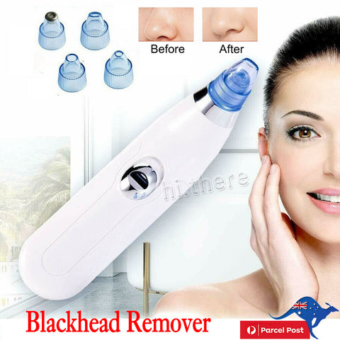 New Electric Blackhead Remover Vacuum Pore Face Facial Suction Acne Cleaner Kit